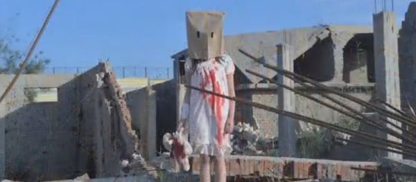 Fake victim from Aleppo Fake victim from Aleppo - Sputnik International