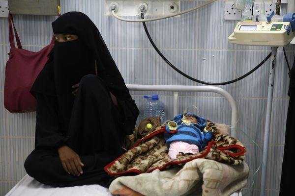 A woman sits next to her malnourished baby at a therapeutic feeding center in a hospital in Sanaa, Yemen. There have been numerous reported cases of dying from starvation in Yemeni hospitals. - Sputnik International