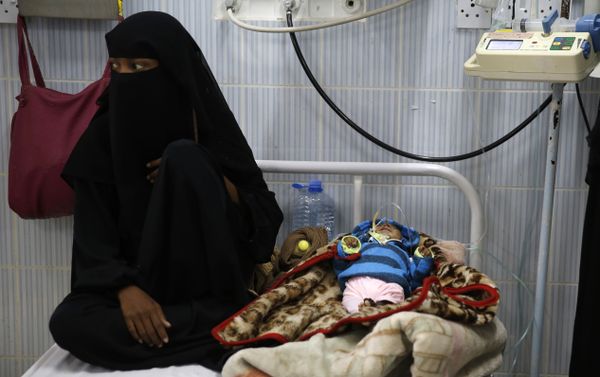 A woman sits next to her malnourished baby at a therapeutic feeding center in a hospital in Sanaa, Yemen. There have been numerous reported cases of dying from starvation in Yemeni hospitals. - Sputnik International