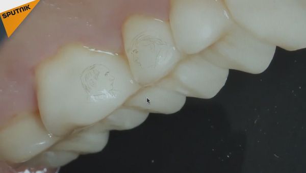 Pictures of Putin and Trump Carved Into Patient's Teeth - Sputnik International