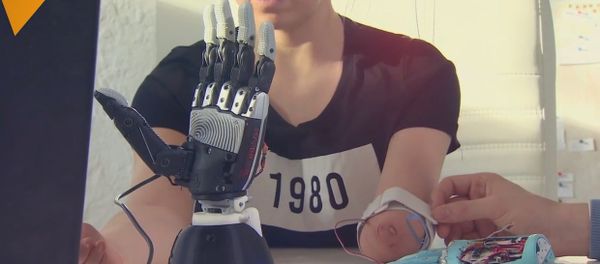 Bionic Arms Produced In Russia Bionic Arms Produced In Russia - Sputnik International