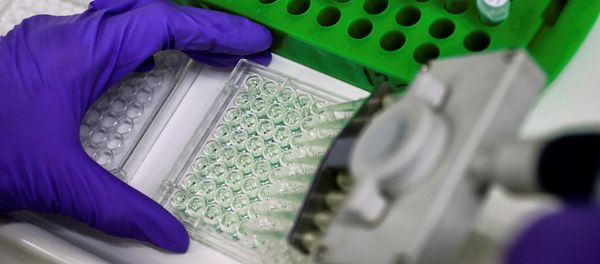 A scientist prepares protein samples for analysis (File) A scientist prepares protein samples for analysis (File) - Sputnik International