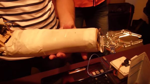 Prosthetic device - Sputnik International