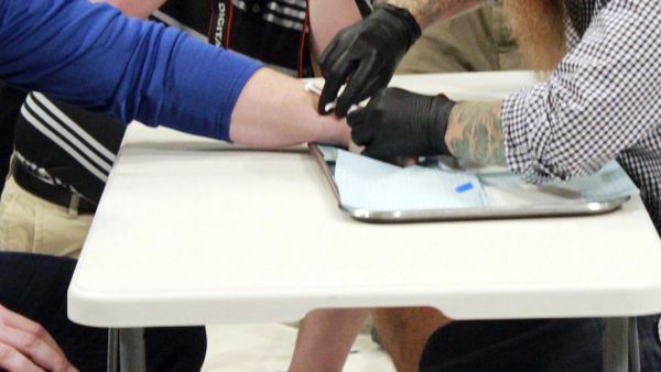 Implanting a microchip - Sputnik International