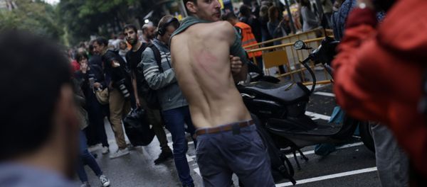 Catalan Referendum: Through Bruises to Independence Catalan Referendum: Through Bruises to Independence - Sputnik International