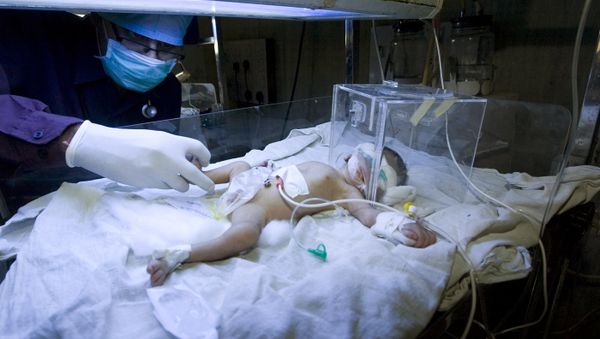 An Indian doctor attends to an unnamed child in The Pediatric Intensive Care Unit at The Civil Hospital in Ahmedabad on February 25, 2009 An Indian doctor attends to an unnamed child in The Pediatric Intensive Care Unit at The Civil Hospital in Ahmedabad on February 25, 2009 - Sputnik International