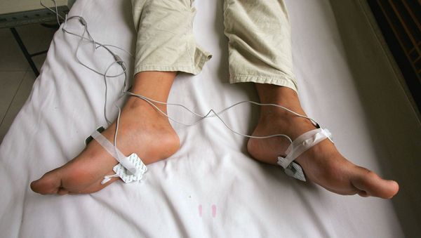 Electric shock treatment. (File) - Sputnik International