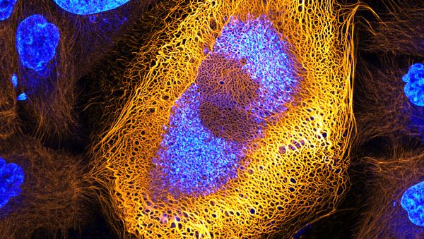 Nikon's Small World: Best Microscope Photos of 2017 - Sputnik International
