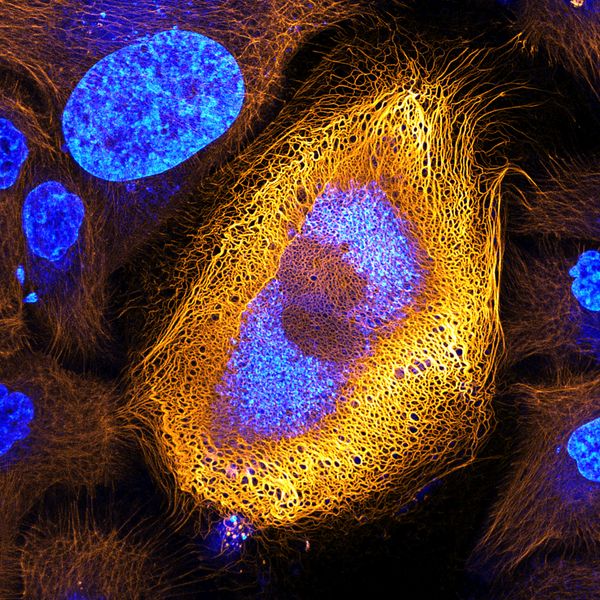 Nikon's Small World: Best Microscope Photos of 2017 Nikon's Small World: Best Microscope Photos of 2017 - Sputnik International