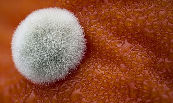 Nikon's Small World: Best Microscope Photos of 2017 Nikon's Small World: Best Microscope Photos of 2017 - Sputnik International