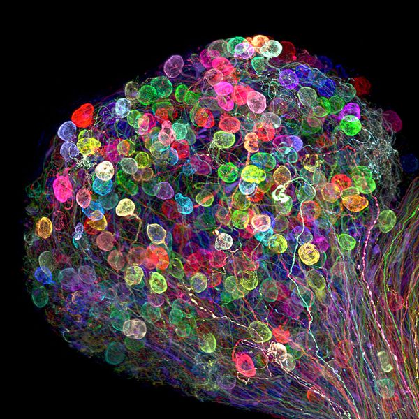 Nikon's Small World: Best Microscope Photos of 2017 Nikon's Small World: Best Microscope Photos of 2017 - Sputnik International