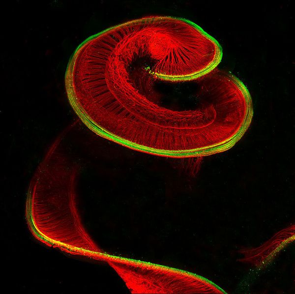 Nikon's Small World: Best Microscope Photos of 2017 Nikon's Small World: Best Microscope Photos of 2017 - Sputnik International