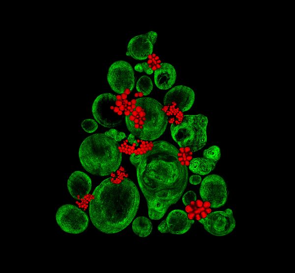 Nikon's Small World: Best Microscope Photos of 2017 Nikon's Small World: Best Microscope Photos of 2017 - Sputnik International
