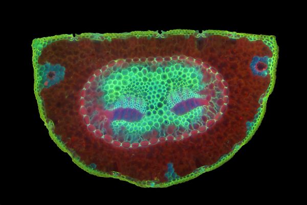 Nikon's Small World: Best Microscope Photos of 2017 Nikon's Small World: Best Microscope Photos of 2017 - Sputnik International
