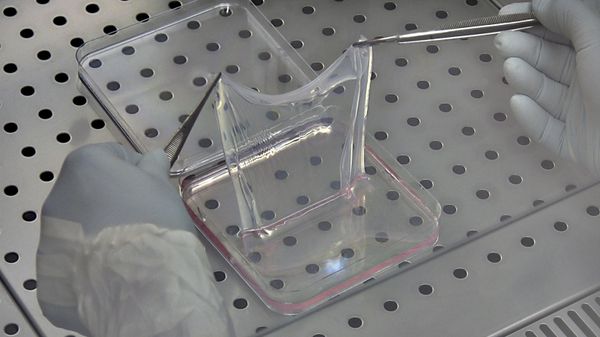 In this undated photo, technicians lift up a sheet of human skin cells at the Center for Regenerative Medicine at the University of Modena in Italy - Sputnik International