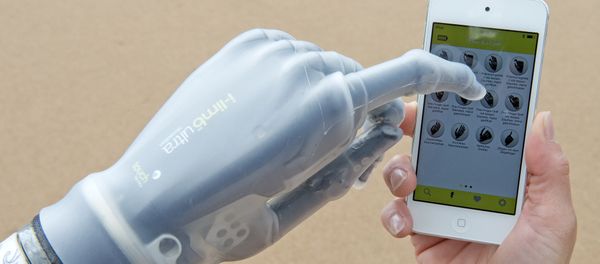 Smartphone controlled bionic hand (i-limb) Smartphone controlled bionic hand (i-limb) - Sputnik International