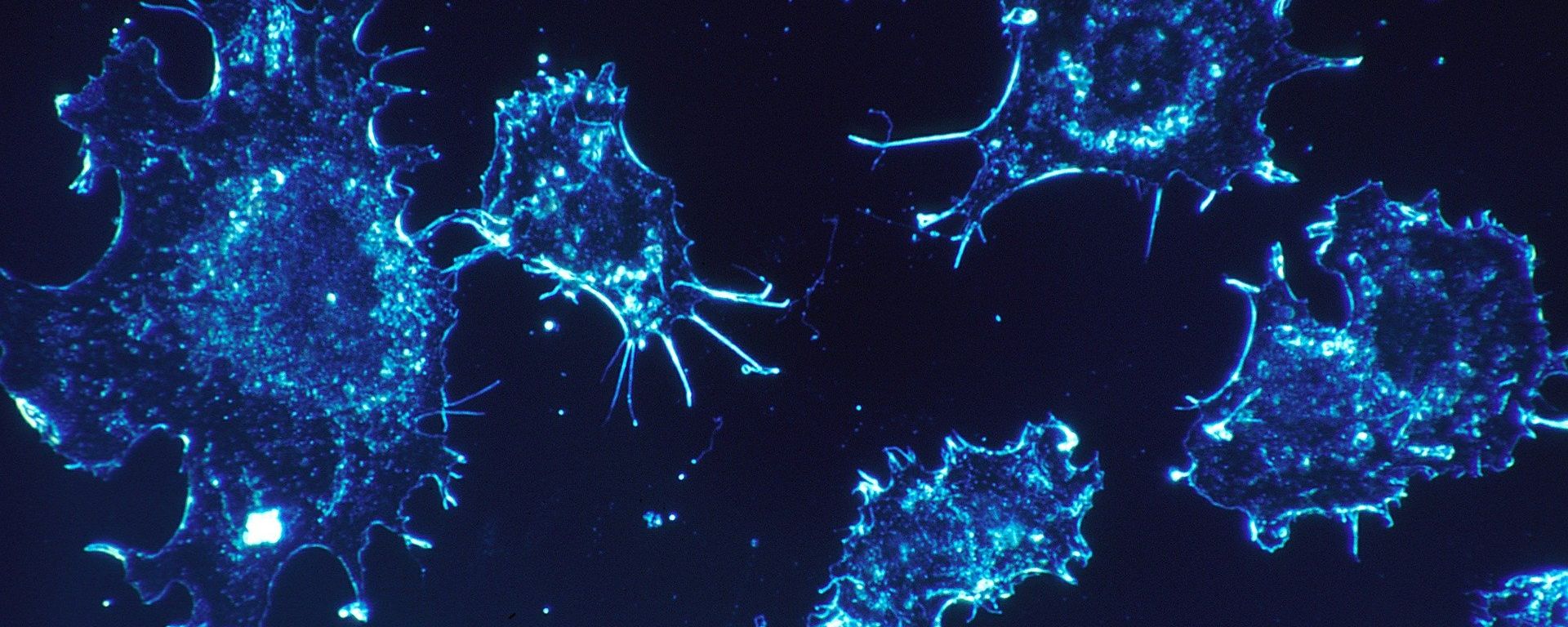 Cancer cells Cancer cells - Sputnik International, 1920, 19.03.2021