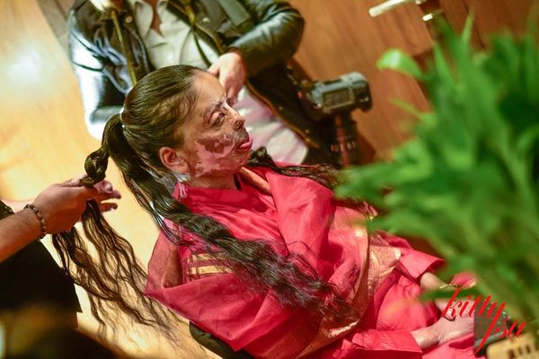 Acid Attack Survivors Fashion Acid Attack Survivors Fashion - Sputnik International