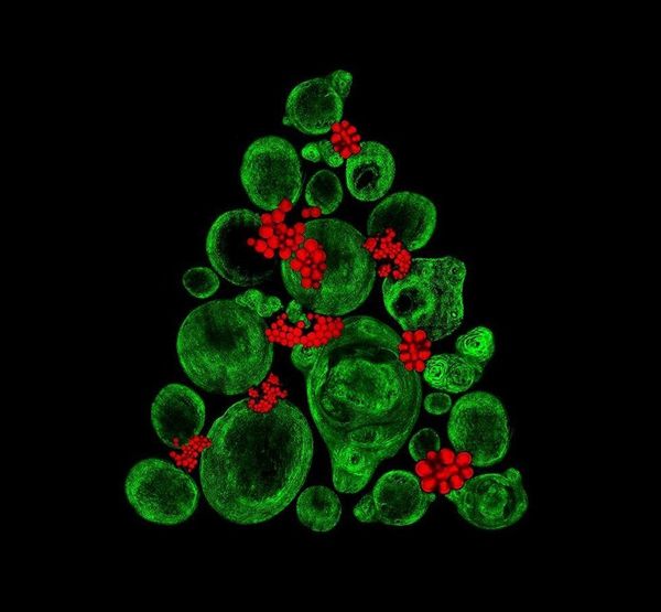 A stem cell Christmas tree - Sputnik International