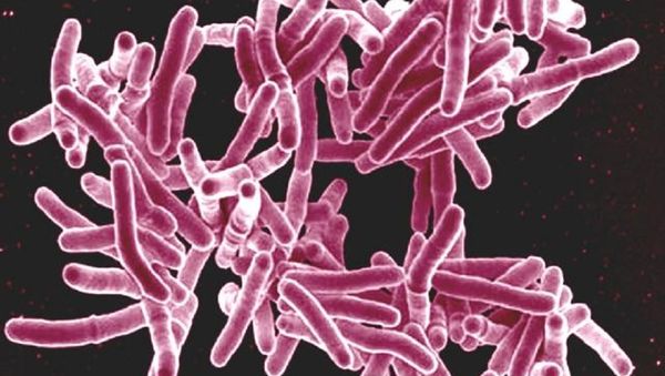 Mycobacterium tuberculosis bacteria - Sputnik International