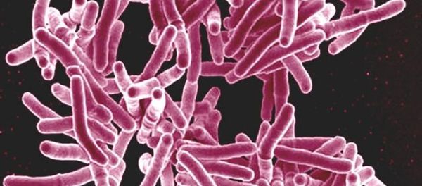Mycobacterium tuberculosis bacteria - Sputnik International