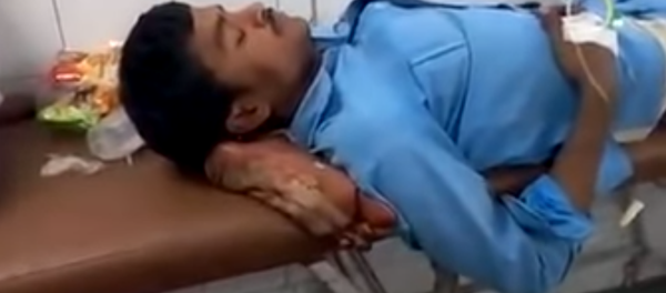 Investigation launched in India after patient's amputated leg was used as pillow Investigation launched in India after patient's amputated leg was used as pillow - Sputnik International