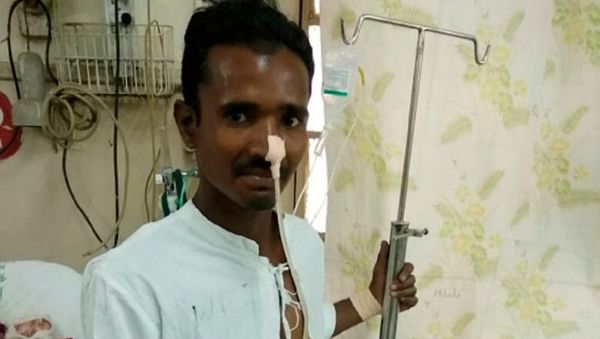 Construction worker survives being impaled by pole through his groin - Sputnik International
