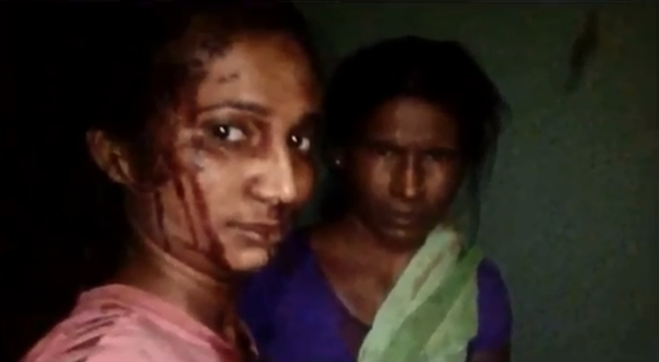 Rupali Meshram and her mother pose for a selfie after Meshram's brawl with a local tiger Rupali Meshram and her mother pose for a selfie after Meshram's brawl with a local tiger - Sputnik International