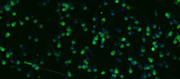 Bovine sperm viewed under a microscope. The sperm cells have been stained with fluorescent probes so that researchers can determine if the acrosome reaction (which helps prepare sperm cells for fertilization of an egg) has occurred in each cell - Sputnik International