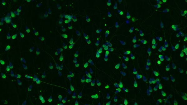 Bovine sperm viewed under a microscope. The sperm cells have been stained with fluorescent probes so that researchers can determine if the acrosome reaction (which helps prepare sperm cells for fertilization of an egg) has occurred in each cell - Sputnik International
