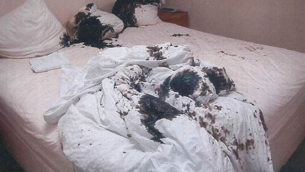 This was the bed in which Mark van Dongen was lying when Berlinah Wallace threw acid on him in 2015 - Sputnik International