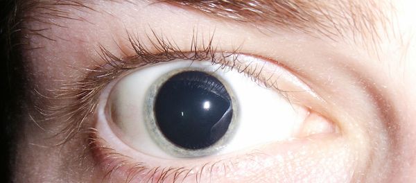 LSD eye - Sputnik International