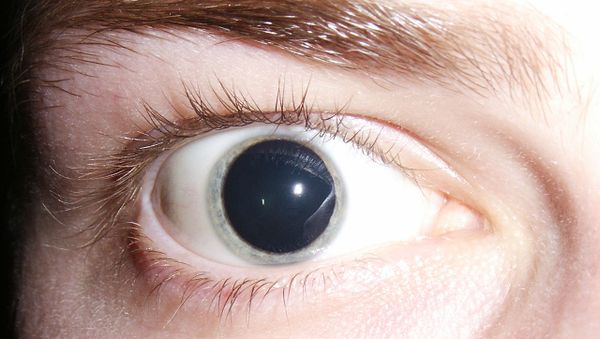 LSD eye - Sputnik International