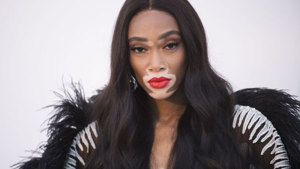 Winnie Harlow - Sputnik International