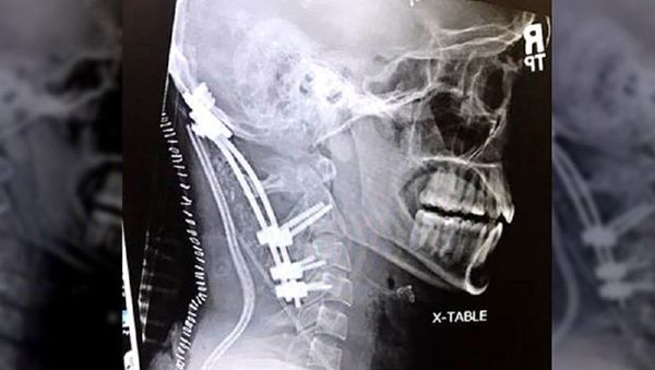 Skull X-ray - Sputnik International