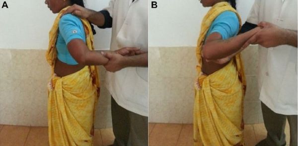 A Woman Who Can Rotate Her Hand 180 Degree A Woman Who Can Rotate Her Hand 180 Degree - Sputnik International