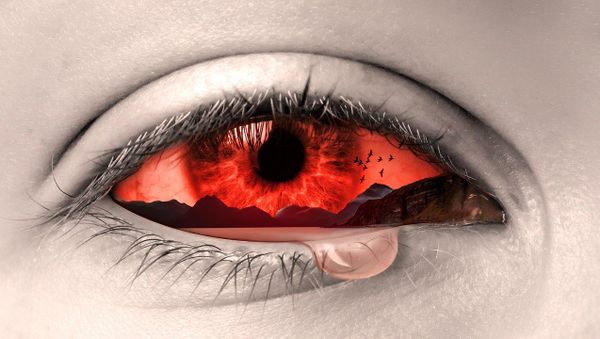 Bloody eye - Sputnik International