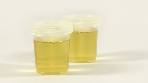 The Test Urine Container - Sputnik International