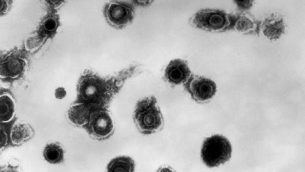 This 1981 electron microscope image made available by the Centers for Disease Control and Prevention shows varicella-zoster virions from a patient with chickenpox. On Thursday, Oct. 11, 2018, the CDC says a small but growing proportion of U.S. toddlers have not been vaccinated against any disease. - Sputnik International