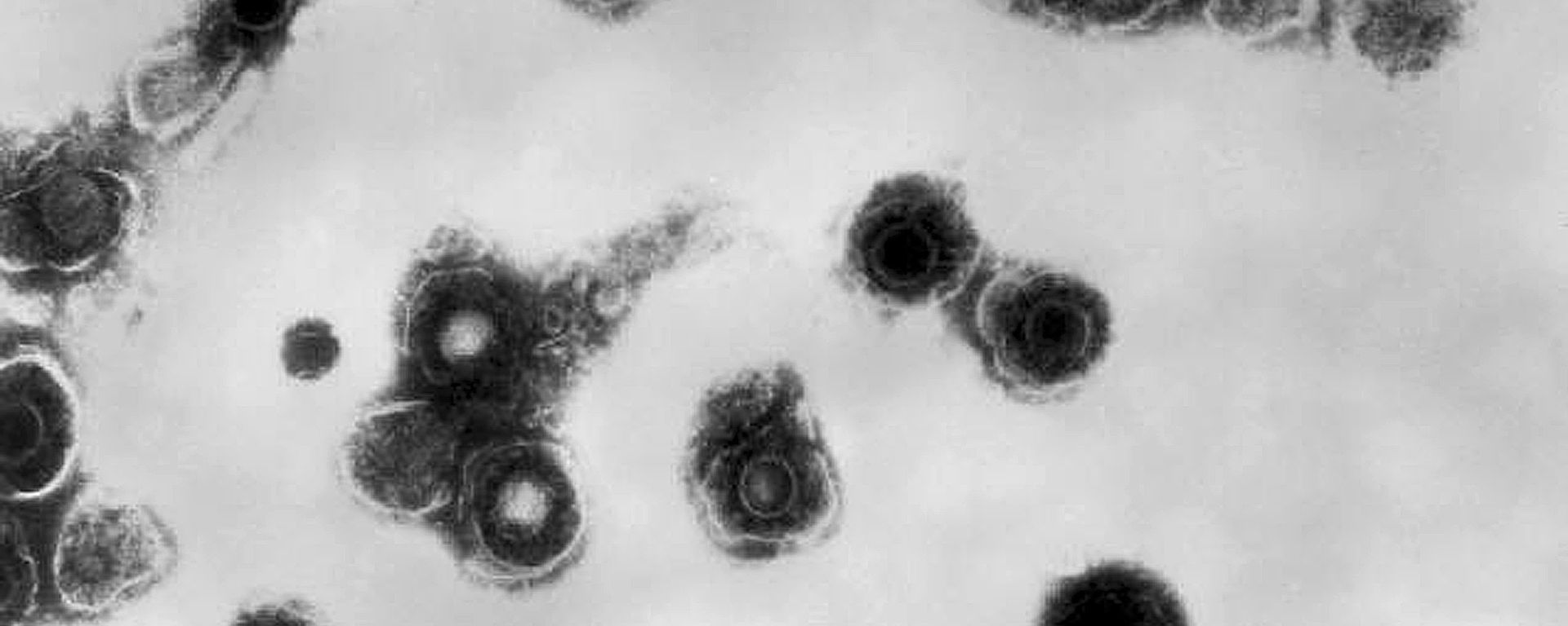 This 1981 electron microscope image made available by the Centers for Disease Control and Prevention shows varicella-zoster virions from a patient with chickenpox. On Thursday, Oct. 11, 2018, the CDC says a small but growing proportion of U.S. toddlers have not been vaccinated against any disease. - Sputnik International, 1920, 22.05.2022
