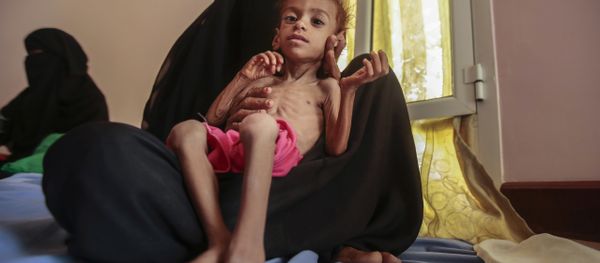 In this Oct. 1, 2018 file photo, a woman holds a malnourished boy at the Aslam Health Center, in Hajjah, Yemen as millions of Yemenis are edging closer to famine and fatal disease one year after a Saudi-led coalition imposed a blockade on sea, land and air routes in the Arab world's poorest country. - Sputnik International