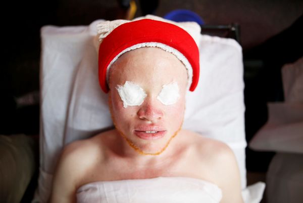 Fairest of Them All: Sneak Peek at Mr & Miss Albinism Kenya Beauty Pageant 2018 Fairest of Them All: Sneak Peek at Mr & Miss Albinism Kenya Beauty Pageant 2018 - Sputnik International
