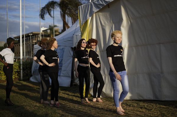 Fairest of Them All: Sneak Peek at Mr & Miss Albinism Kenya Beauty Pageant 2018 Fairest of Them All: Sneak Peek at Mr & Miss Albinism Kenya Beauty Pageant 2018 - Sputnik International