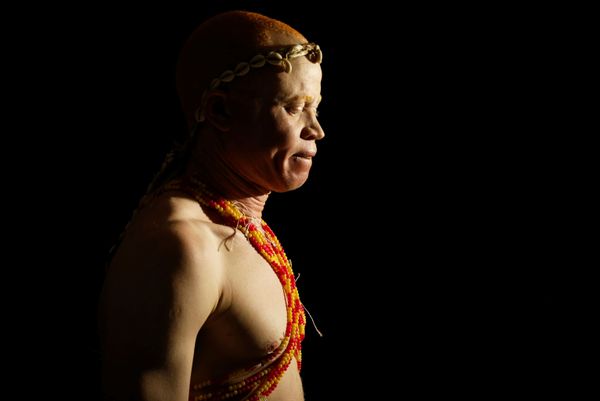 Fairest of Them All: Sneak Peek at Mr & Miss Albinism Kenya Beauty Pageant 2018 Fairest of Them All: Sneak Peek at Mr & Miss Albinism Kenya Beauty Pageant 2018 - Sputnik International