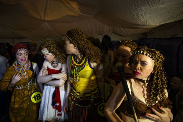Fairest of Them All: Sneak Peek at Mr & Miss Albinism Kenya Beauty Pageant 2018 Fairest of Them All: Sneak Peek at Mr & Miss Albinism Kenya Beauty Pageant 2018 - Sputnik International