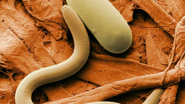 Soybean cyst nematode and its egg - Sputnik International