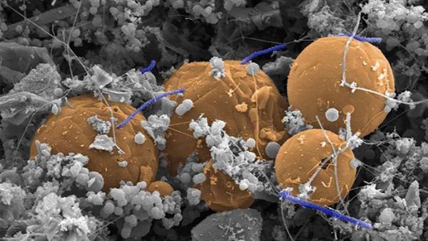 Candidatus Desulforudis audaxviator (purple bacteria straddling orange carbon spheres) from under Mponeng gold mine in South Africa - Sputnik International