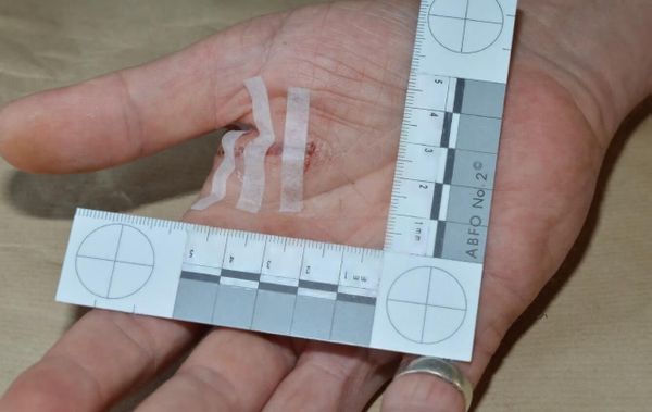 A police officer received this injury as he grappled with Mohiussunnath Chowdhury, who was carrying a samurai sword - Sputnik International
