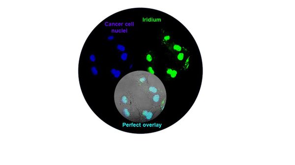 Nucleus‐Targeted Organoiridium–Albumin Conjugate for Photodynamic Cancer Therapy Nucleus‐Targeted Organoiridium–Albumin Conjugate for Photodynamic Cancer Therapy - Sputnik International