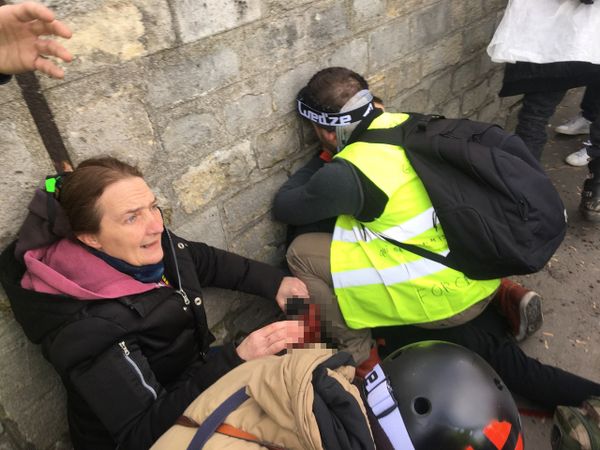 Yellow Vests Protester Gets Hand Blown off by Grenade in Paris Yellow Vests Protester Gets Hand Blown off by Grenade in Paris - Sputnik International